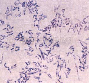 白喉棒状杆菌的菌体