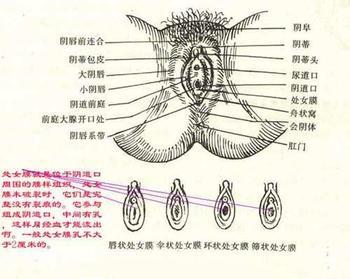 当病原体侵入<em>阴道</em>,在一定的条件下使<em>阴道</em>黏膜