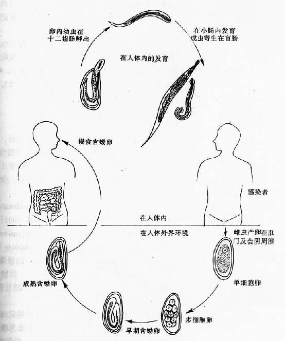 成蟲寄生於人體的盲腸,闌尾,結腸,直腸及迴腸下段,重度感染時